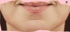 Chin & Jaw Line Threading