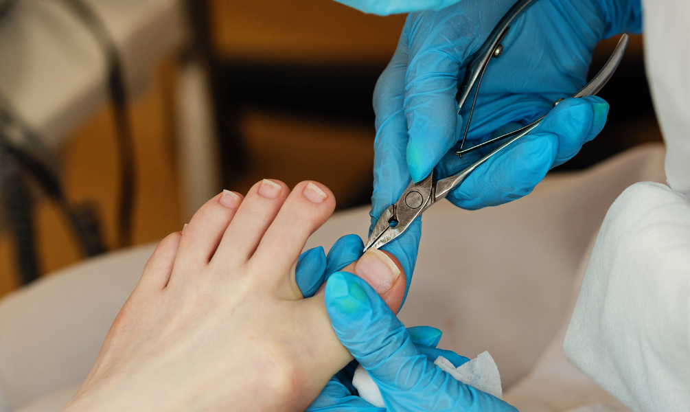 Pedicure