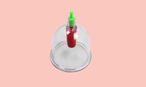 Cupping