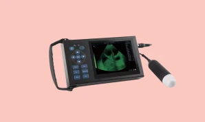 Digital Ultrasonic Diagnostic