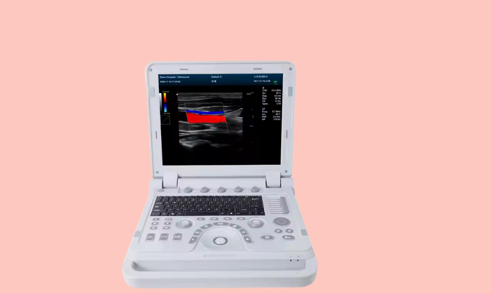 Portable Ultrasound Machine Color Doppler Ultrasonic Diagnostic