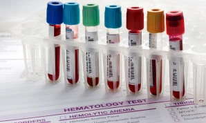Rheumatology