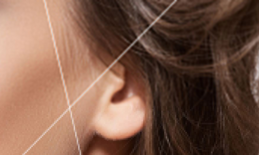 Face side lock
