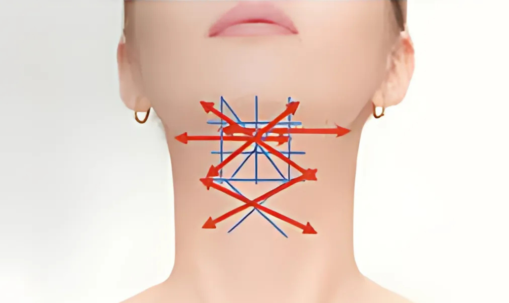 Front Neck Threading